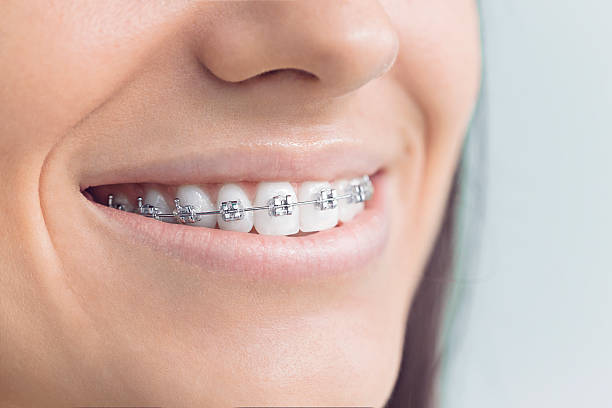 Best Full Mouth Reconstruction  in Carpentersvle, IL